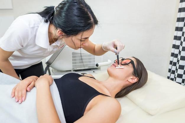 lip and chin laser hair removal