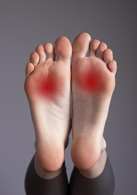 can oofos cause plantar fasciitis