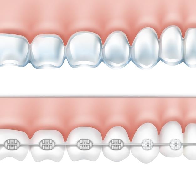 dental implant cost indiana