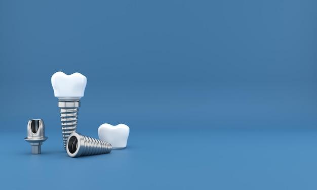 how much are dental implants indiana