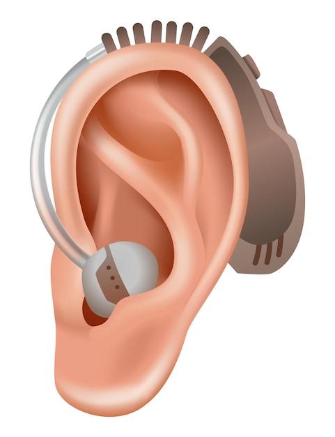 how much does a cros hearing aid cost