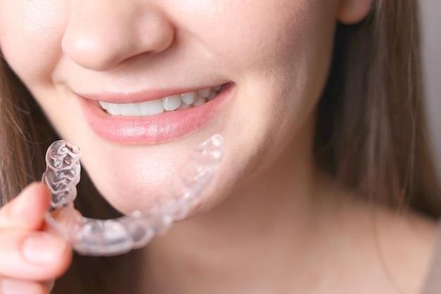 how much does invisalign cost for upper teeth only