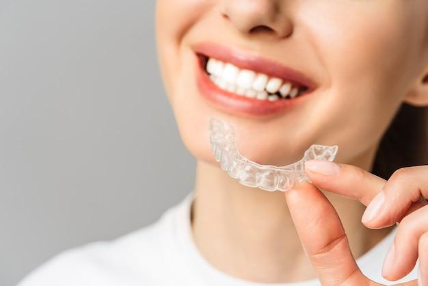 how much is invisalign just for top teeth