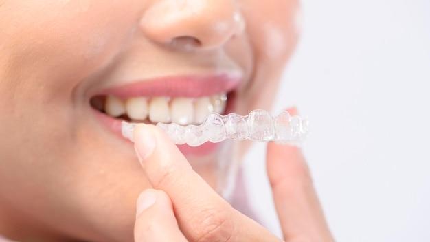 how much is invisalign if you ve already had braces