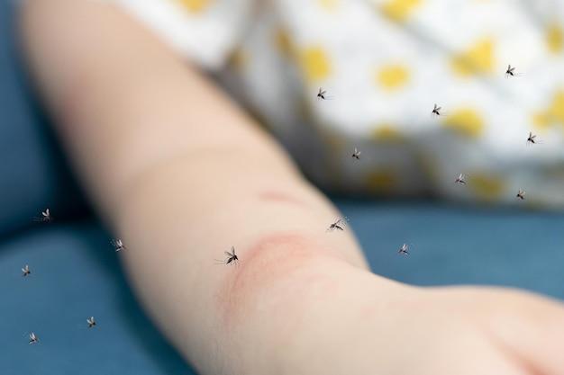 how to tell a spider bite from a mosquito bite