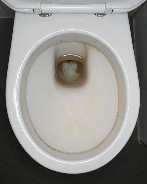 water in toilet bowl low