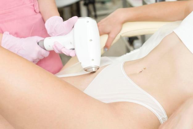 hyperpigmentation bikini line laser treatment