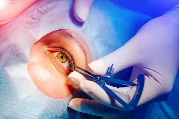 lasik eye surgery philippines