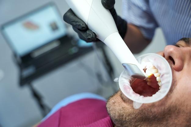 root canal laser treatment cost
