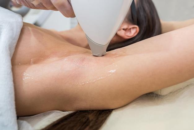 what is a small area in laser hair removal