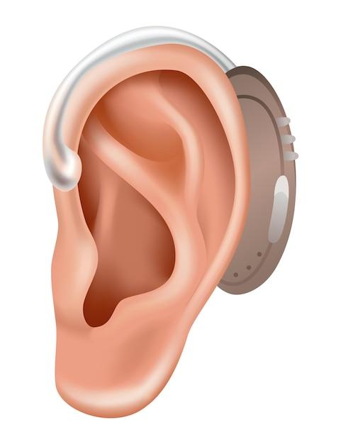 hearing aid for ruptured eardrum