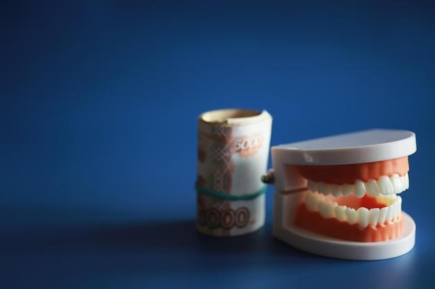 why are dental implants expensive