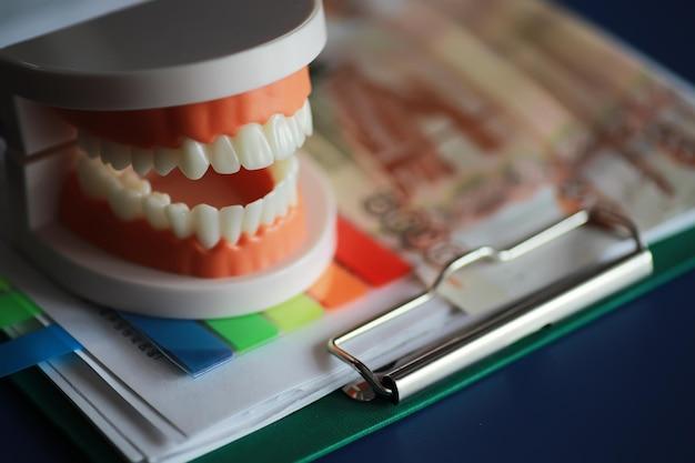 why are dental implants expensive