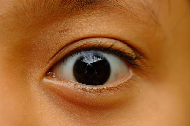 What is Chinese eye color?