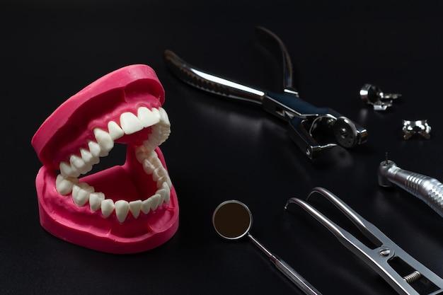 how much do dental implants cost in washington state