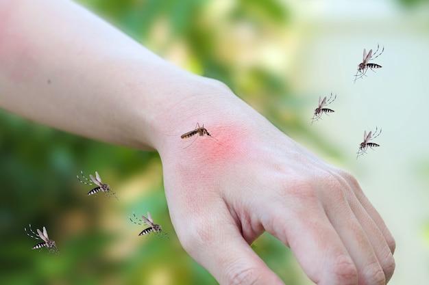 how to tell spider bite from mosquito