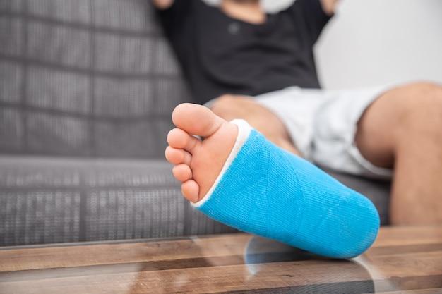 Can You Remove Cast At Home 
