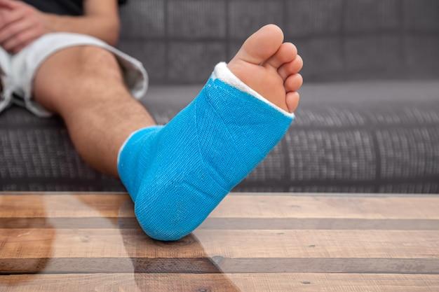 Can You Remove Cast At Home 