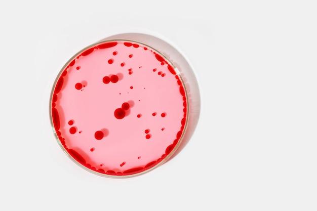 Does Dish Soap Kill Salmonella 