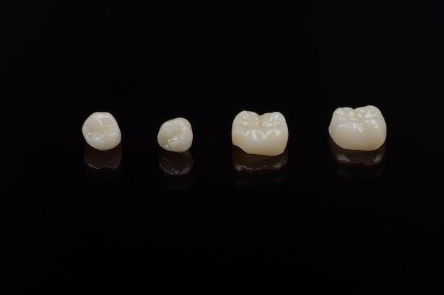  Does Insurance Cover Zirconia Crowns 