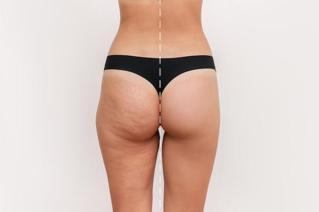 How Long Does It Take To Tone Your Butt 