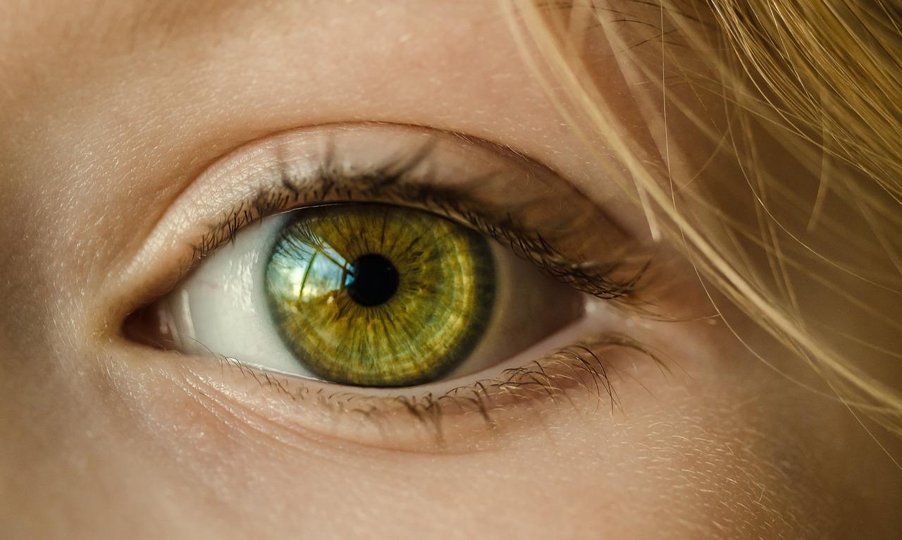  How Rare Are Yellow Green Eyes 