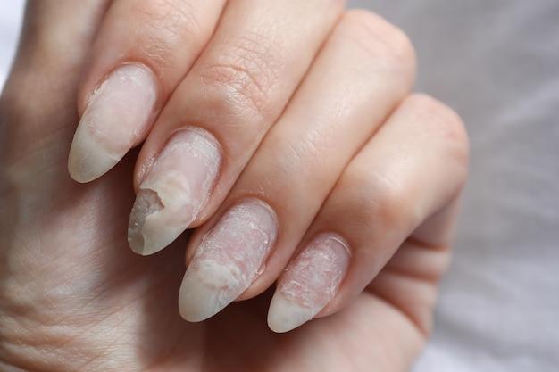  How To Get Wax Off Nails 
