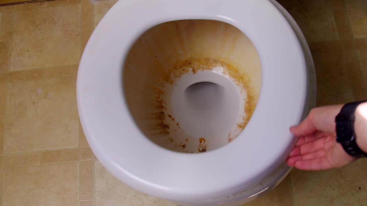 How To Remove Poop Stains From Toilet Seat 