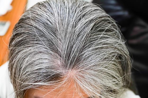  Is There A Hair Dye That Only Covers Grey 