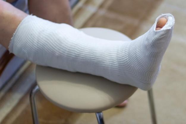  Is There An Alternative To A Plaster Cast 