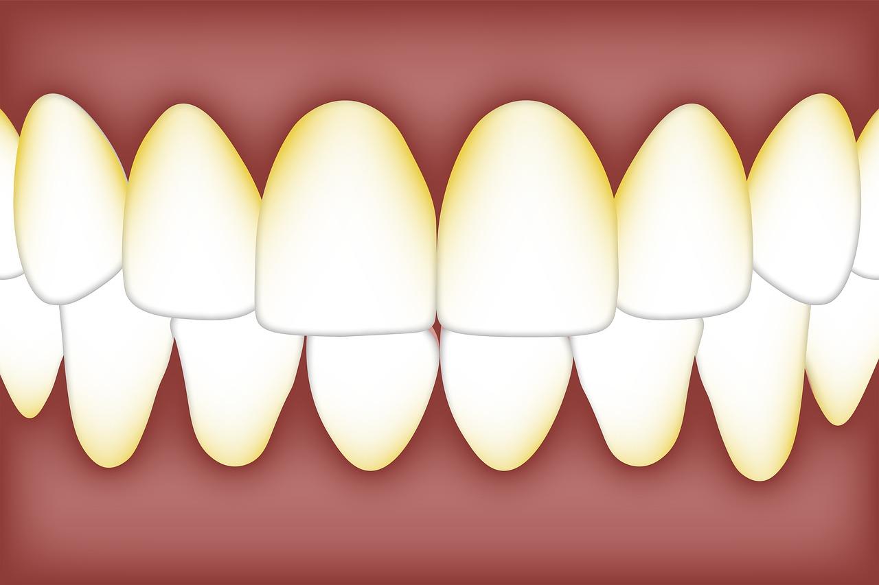 What Are The Side Effects Of Gold Teeth 