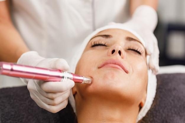 What To Apply After Diy Power Micro Needling 